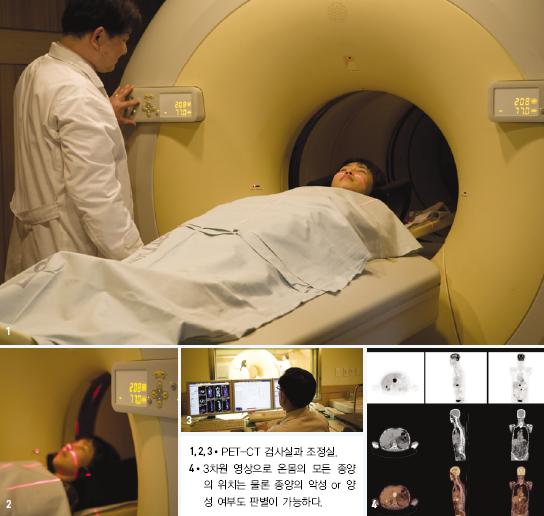 PET-CT